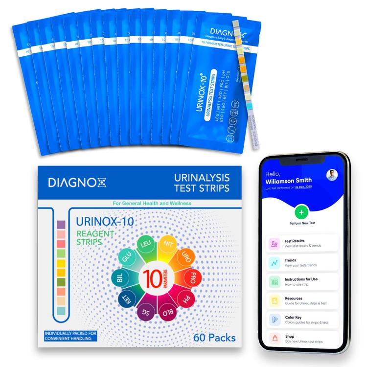 Diabetic Urinalysis Test Strips